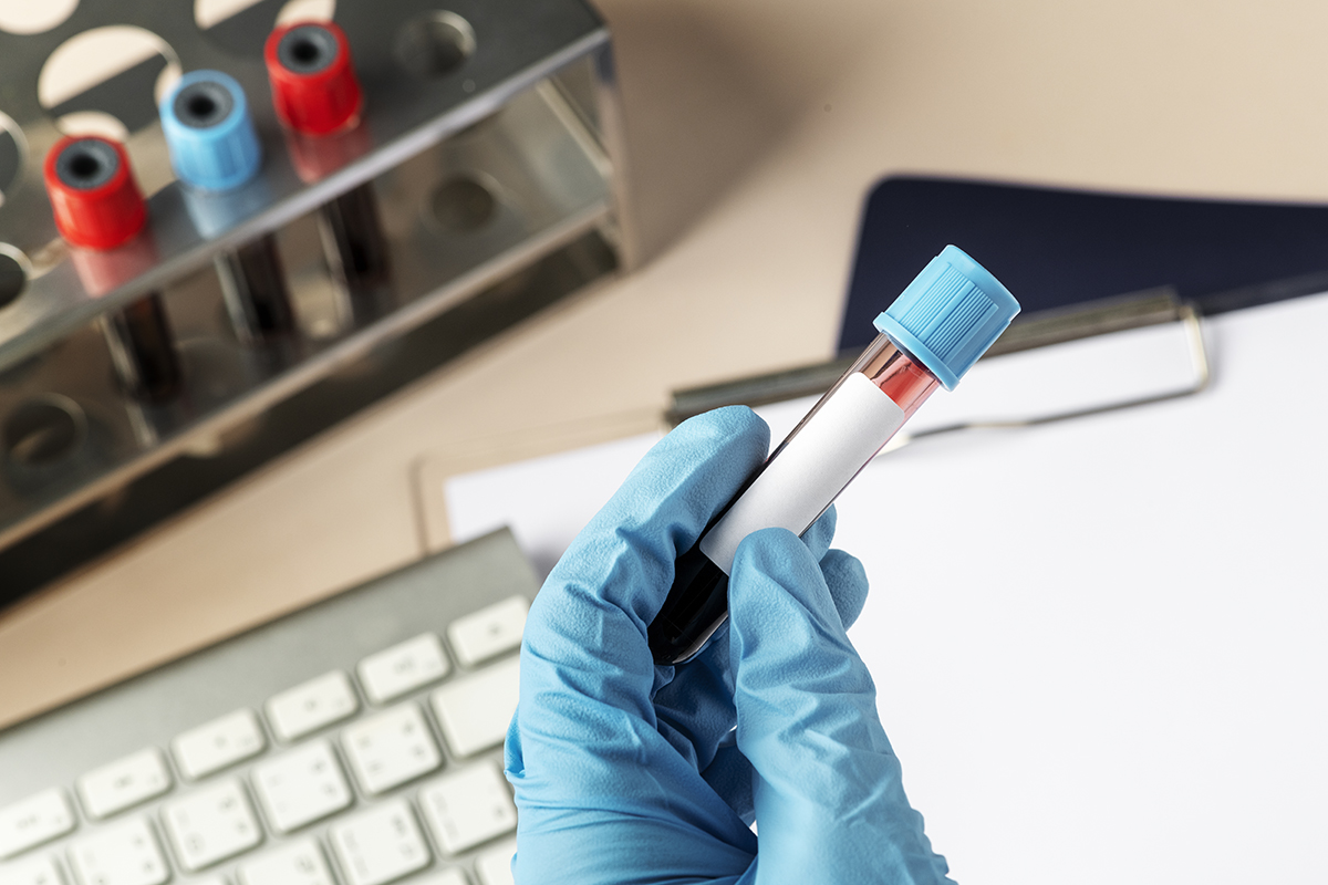 Hepatita B și C: Importanța testelor de screening